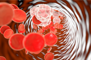 5 Quick Ways to Get Rid of Inflammatory Fat